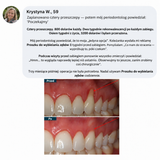Proszek do wybielania zębów zatwierdzony przez dentystów